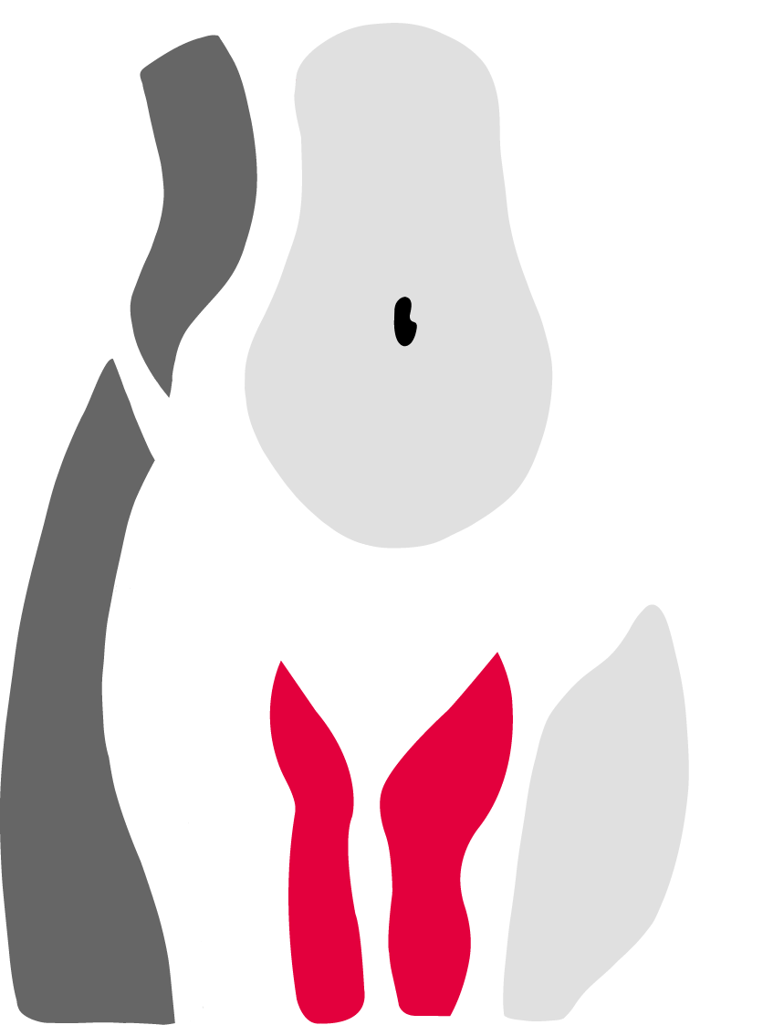 Oberschenkelstraffung_NEU