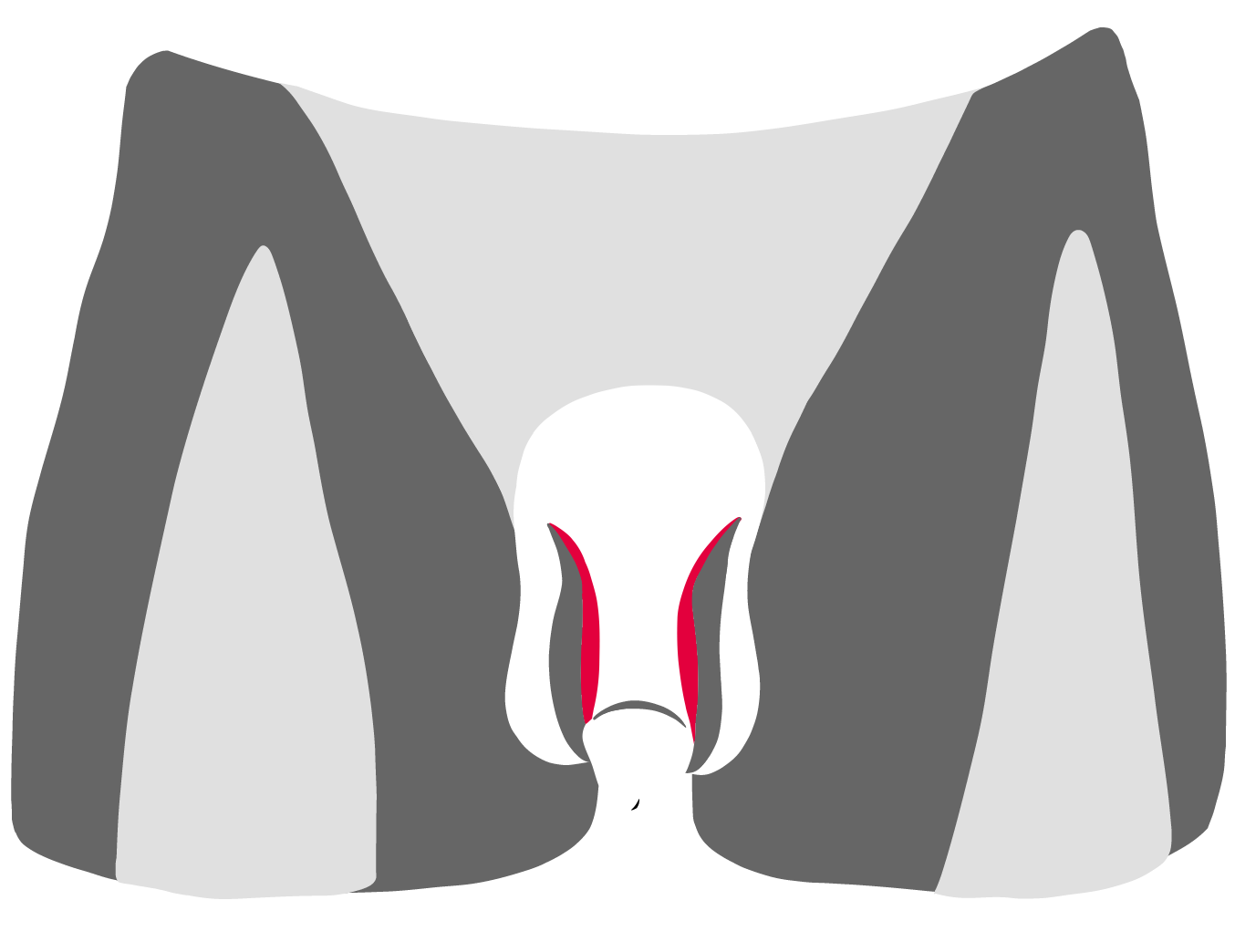 Penis-verdickung