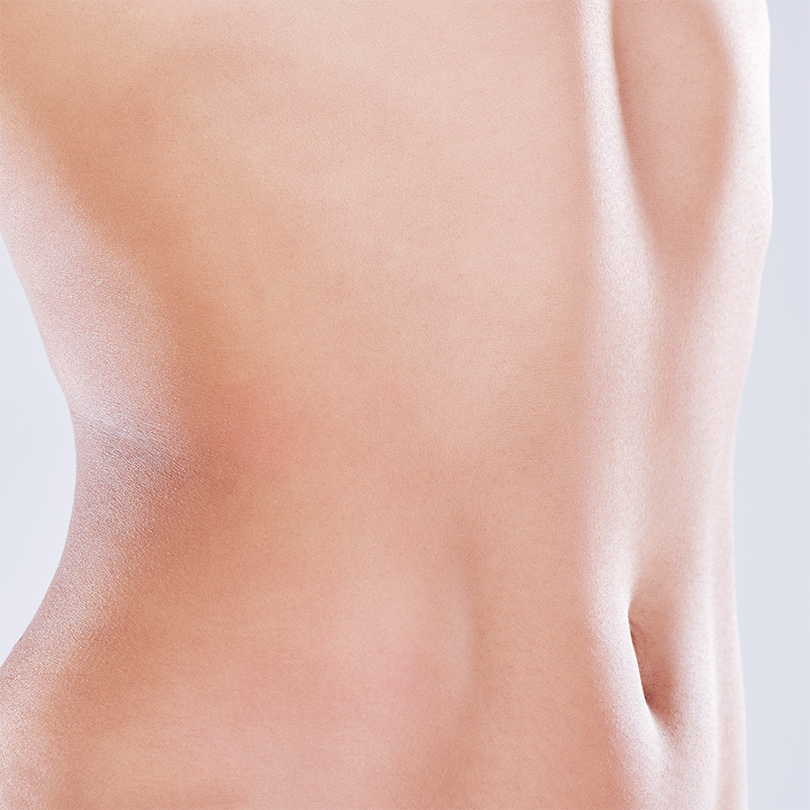 Überlegene Ergebnisse gegenüber traditioneller Liposuktion